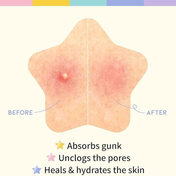 180 Pcs Pimple Patches