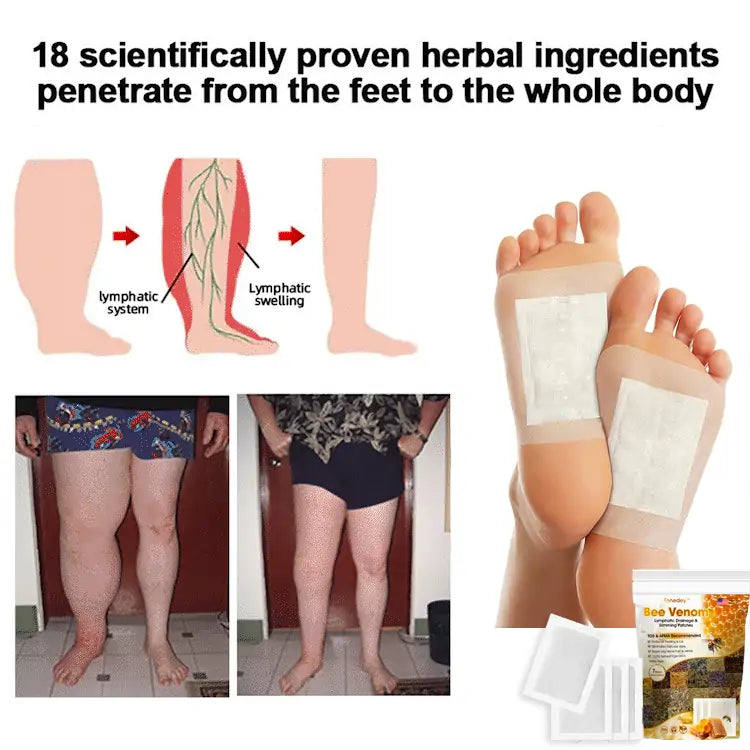 Bee Venom Slimming Foot Patches - Get Slim Fast 🔥